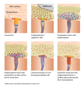 Aluminum in Antiperspirants – Appalachian Spring Dermatology